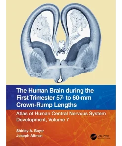 The Human Brain during the First Trimester 57- to 60-mm Crown-Rump Lengths