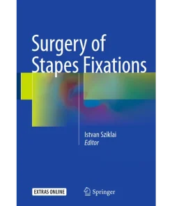 Surgery of Stapes Fixations