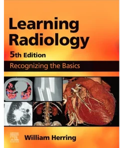 Learning Radiology Recognizing the Basics
