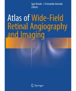 Atlas of Wide-Field Retinal Angiography and Imaging