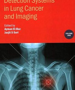Detection Systems in Lung Cancer and Imaging