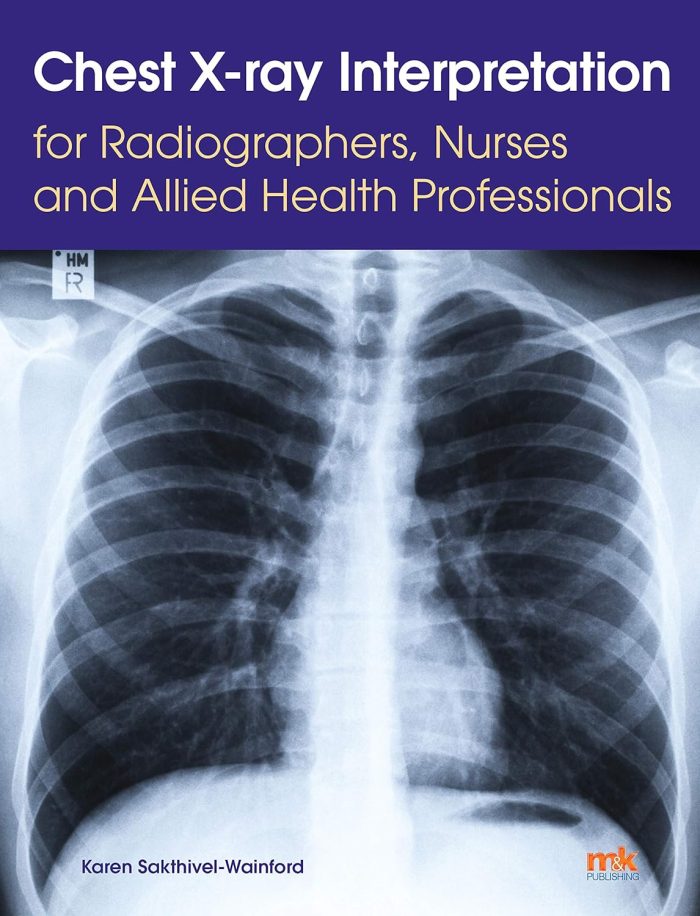 Chest X-ray Interpretation