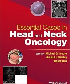 Essential cases in head and neck oncology