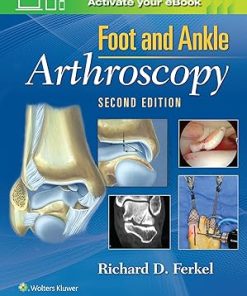 Foot & Ankle Arthroscopy