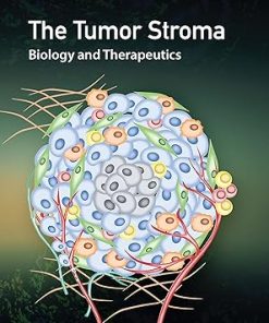 The Tumor Stroma