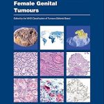 World Health Organization Female Genital Tumours
