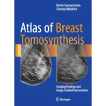 Atlas of Breast Tomosynthesis