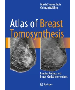 Atlas of Breast Tomosynthesis