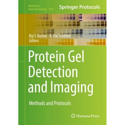 Protein Gel Detection and Imaging Methods and Protocols