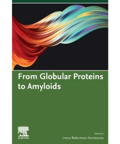 From Globular Proteins to Amyloids