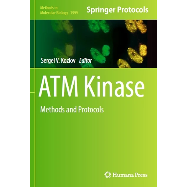 ATM Kinase Methods and Protocols