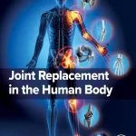 Joint Replacement in the Human Body