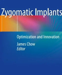 Zygomatic Implants Optimization and Innovation