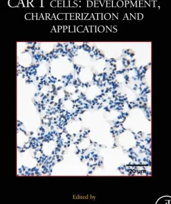 MCB CAR T Cells Development Characterization and Applications (Volume 167)