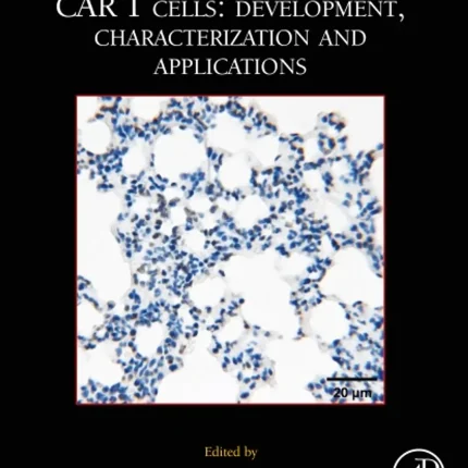 MCB CAR T Cells Development Characterization and Applications (Volume 167)