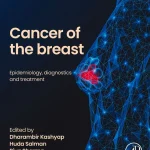 Cancer of the Breast Epidemiology Diagnostics and Treatment