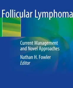Follicular Lymphoma