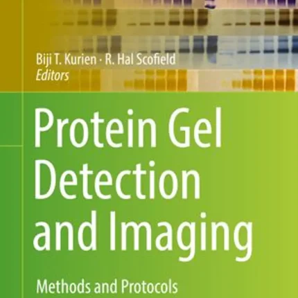 Protein Gel Detection and Imaging Methods and Protocols