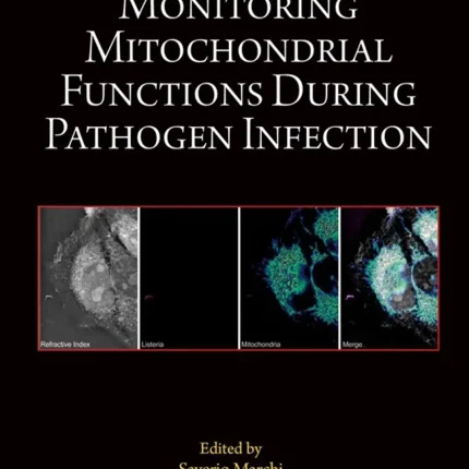 Methods for Monitoring Mitochondrial Functions During Pathogen Infection