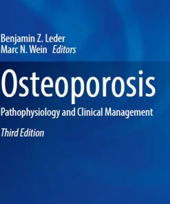 Osteoporosis Pathophysiology and Clinical Management