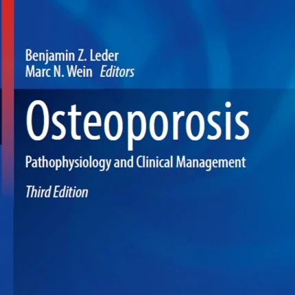 Osteoporosis Pathophysiology and Clinical Management
