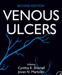 Venous Ulcers