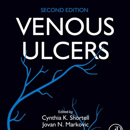 Venous Ulcers