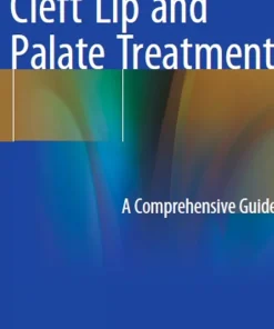 Cleft Lip and Palate Treatment A Comprehensive Guide