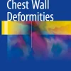 Chest Wall Deformities