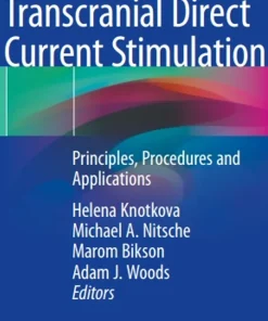 Practical Guide to Transcranial Direct Current Stimulation