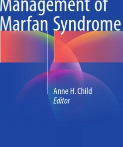 Diagnosis and Management of Marfan Syndrome