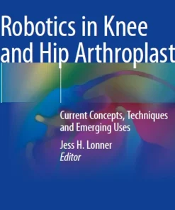 Robotics in Knee and Hip Arthroplasty