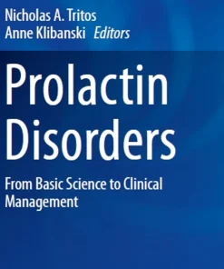 Prolactin Disorders From Basic Science to Clinical Management