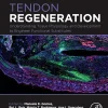 Tendon Regeneration