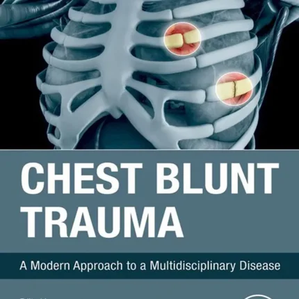 Chest Blunt Trauma