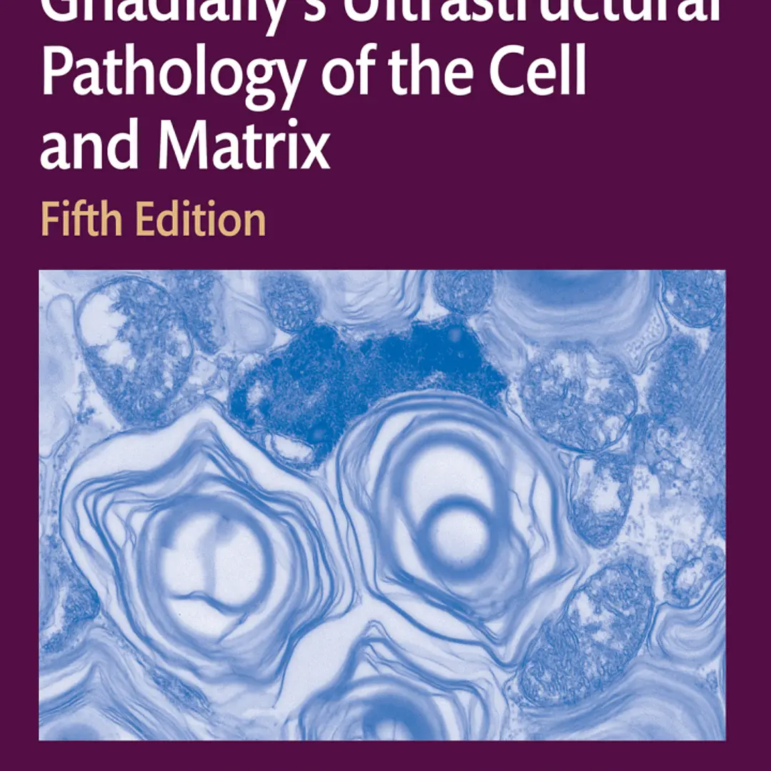 Ultrastructural Pathology of the Cell and Matrix