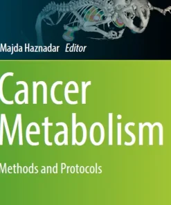 Cancer Metabolism: Methods and Protocols