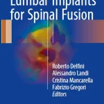 Modern Thoraco-Lumbar Implants for Spinal Fusion