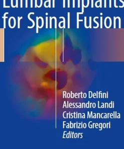 Modern Thoraco-Lumbar Implants for Spinal Fusion