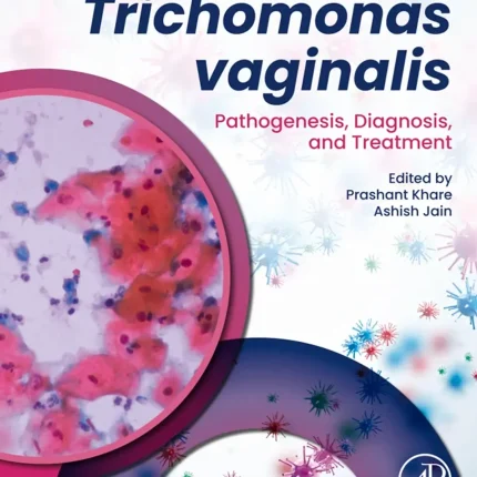 Trichomonas Vaginalis
