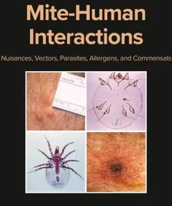 Mite-Human Interactions