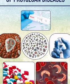The Diagnosis and Treatment of Protozoan Diseases