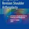 Complex and Revision Shoulder Arthroplasty