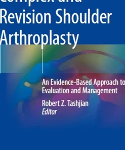 Complex and Revision Shoulder Arthroplasty