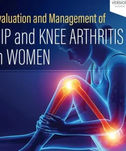 Evaluation and Management of Hip and Knee Arthritis in Women