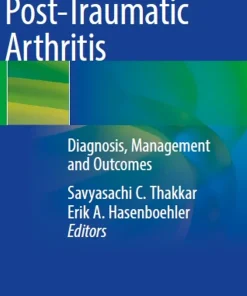 Post-Traumatic Arthritis Diagnosis Management and Outcomes