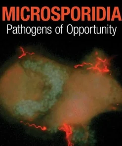 Microsporidia Pathogens of Opportunity
