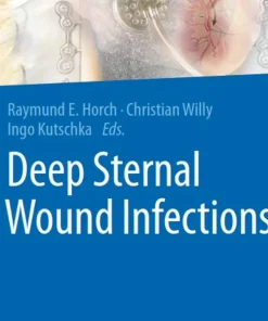 Deep Sternal Wound Infections