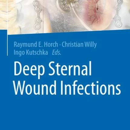 Deep Sternal Wound Infections