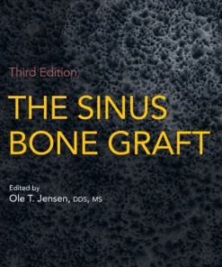 The Sinus Bone Graft